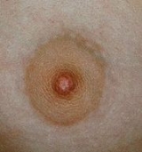 Areola Pimple