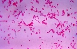 Fusobacterium+necrophorum+gram+stain