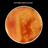 yokogawa payslips example some examples of strictly aerobic bacteria include bacillusnocardia facultative anaerobes 