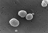 streptococcus bovis colony color